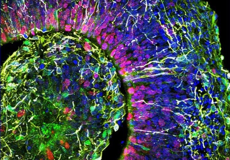 Human-Like Brain Waves Detected In Lab-Grown Minibrains