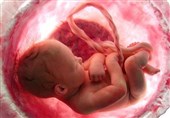 روزانه بیش از 1000 &quot;سقط جنین&quot; در کشور اتفاق می‌افتد؛ مقصر کیست؟!