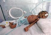 Saudi-Led War Causing over 80 Daily Deaths among Yemeni Newborns: Health Ministry