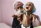 گزارش ایندیپندنت از سوءتغذیه وحشتناک کودکان یمنی