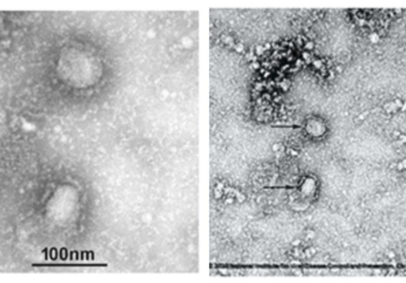First Photos of Deadly Coronavirus Released by Chinese Authorities