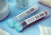 Iranian Coronavirus Diagnostic Test Kits Ready to Hit Global Market