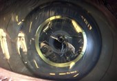 Researchers Say Bionic Eye Coming in Five Years