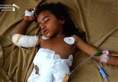 UN to Suspend 3 Quarters of Medical Aid in Yemen due to Lack of Funds