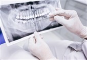 تذکر یک دندانپزشک به مسئولان /آینده ارائه خدمات دندانپزشکی در ایران در خطر است