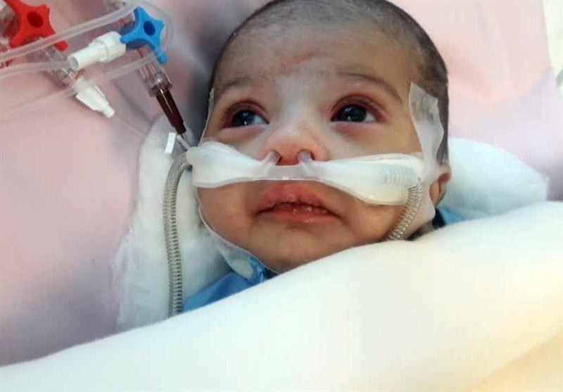 عمل قلب باز کودک 26 روزه در مشهد با موفقیت انجام شد
