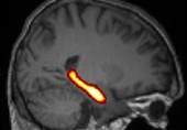 Study Links Daily Job's Physical Stress to Cognitive Decline, Memory Loss