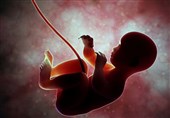 آیا تشخیص بیماری در جنین، مجوّز سقط آن است؟ / پاسخ از آیت الله خامنه ای