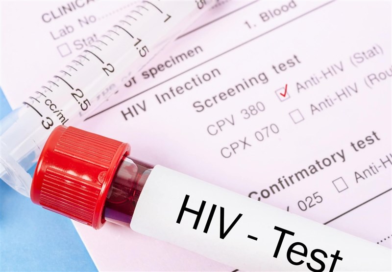 درمان ایدز امکان‌پذیر شد/درمان یک زن مبتلا به HIV با پیوند سلول‌های بنیادی