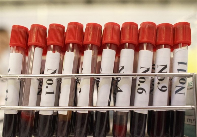Australia Scraps Covid-19 Vaccine Development After Trials Lead to False HIV Positive