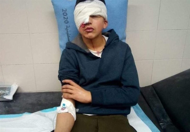 کودک فلسطینی به ضرب گلوله نظامیان صهیونیست نابینا شد