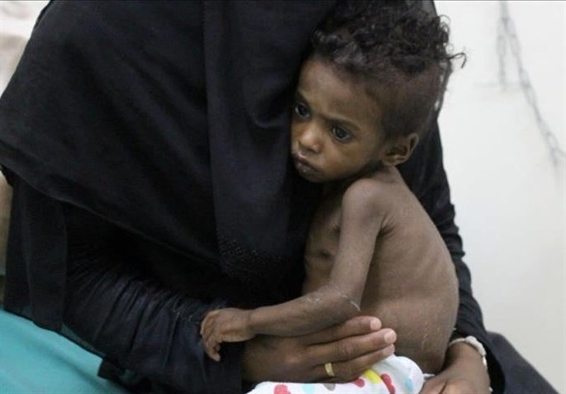 هشدار وزارت بهداشت یمن: تحریم‌ها فعالیت درمانی را مختل کرده است