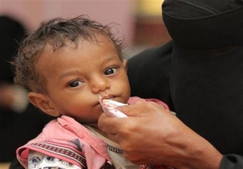 الصحة العالمیة تحذر من سوء التغذیة الحاد بین أطفال الیمن