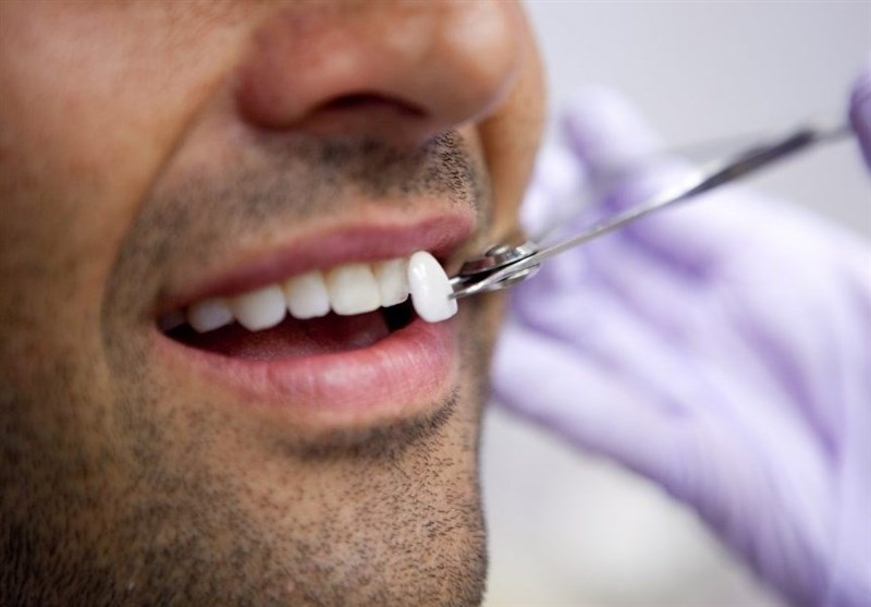 با 5 تا از گرانترین درمان های دندانپزشکی در جهان آشنا شوید