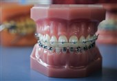 آشنایی با 7 گام اساسی در مراحل ارتودنسی دندان