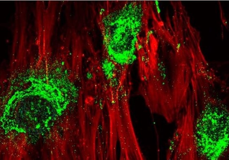 Scientists Use Sound Waves to Turn Human Stem Cells into Bone Cells