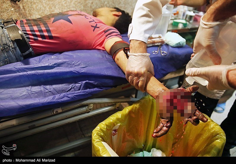حوادث چهارشنبه آخر سال در همدان آغاز شد؛ مصدومیت 8 نفر با مواد محترقه