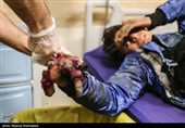 آمار نهایی تلفات چهارشنبه سوری در قزوین / 112 نفر مصدوم شدند