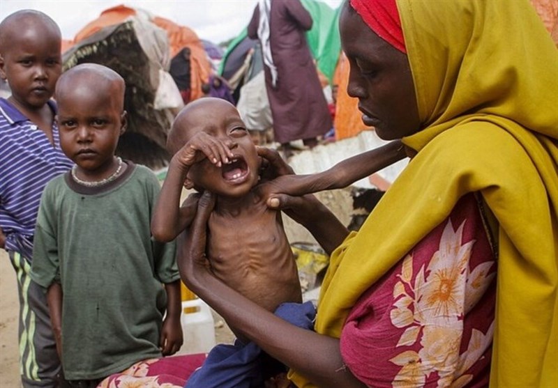 یونیسف: 730 کودک در سومالی بر اثر گرسنگی جان دادند