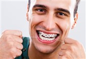 روش های مراقبت از ارتودنسی دندان