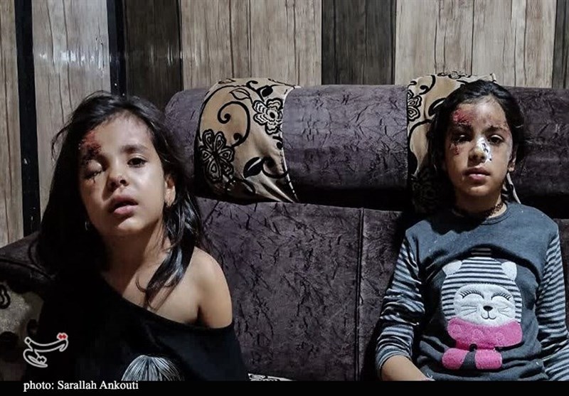 ماجرای حمله سگ‌های ولگرد به دو دختربچه در کرمان چه بود؟+ فیلم و عکس