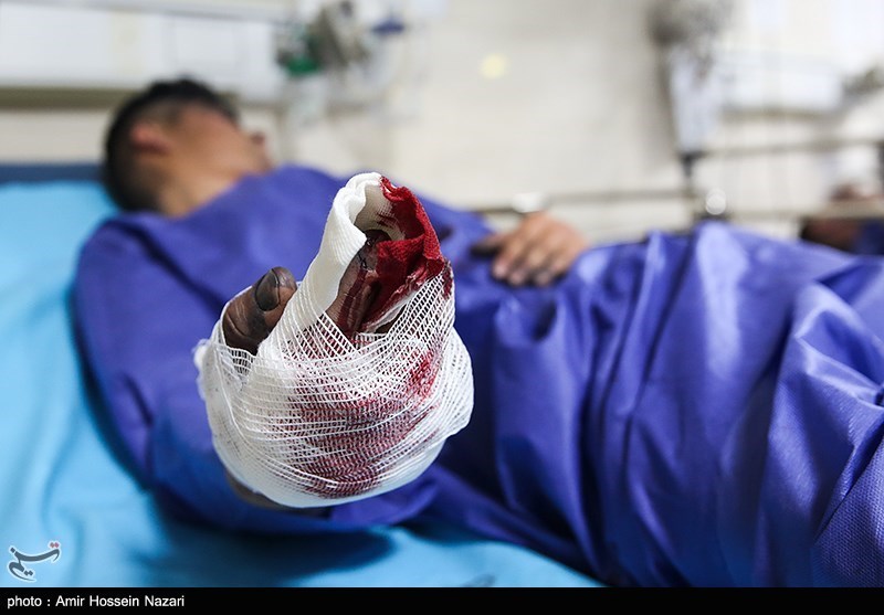 آمار نهایی مصدومان چهارشنبه‌سوری در قزوین؛ 132 نفر مصدوم و یک کشته