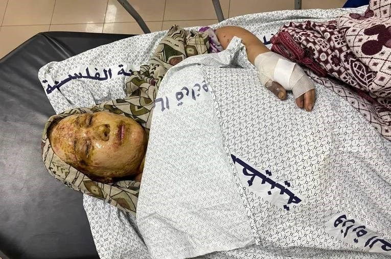 مرگ تدریجی بیماران در غزه/ هشدار درباره شیوع اپیدمی‌های خطرناک با ورود به فصل سرما