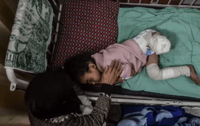 یونیسف: در تجاوزات اسرائیل پای بیش از 1000 کودک در غزه قطع شده است