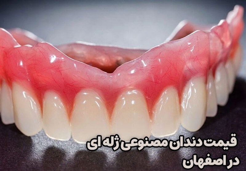 قیمت دندان مصنوعی ژله ای در اصفهان