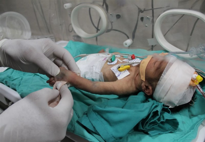 Child Deaths Surge in Gaza As Malnutrition, Dehydration Crisis Deepens