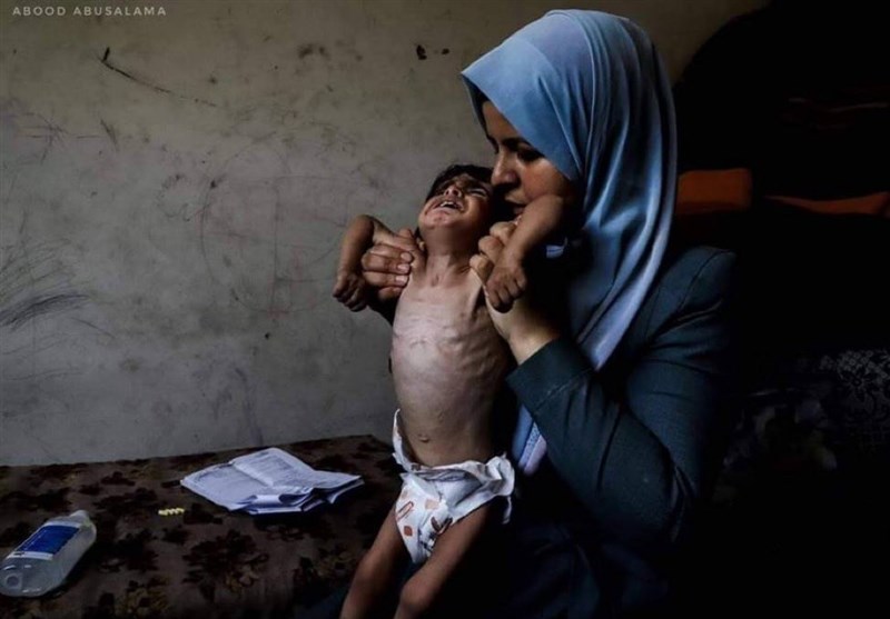 Gazze&apos;de İnsani Dram, Çocuklar Açlıktan Ölüyor