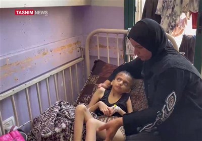 أطفال غزة یموتون اما بالقصف واما بسبب الجوع والعالم لا یحرک ساکنا