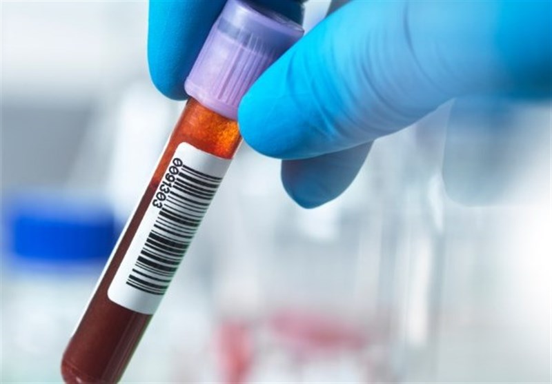Blood Test for Alzheimer&apos;s Shows High Accuracy, Study Finds