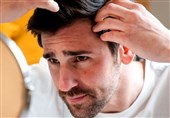 New Evidence Suggests Stress Can Speed Up Hair Graying