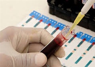 کاهش شیوع HIV در میان معتادان تزریق‌کننده مواد مخدر