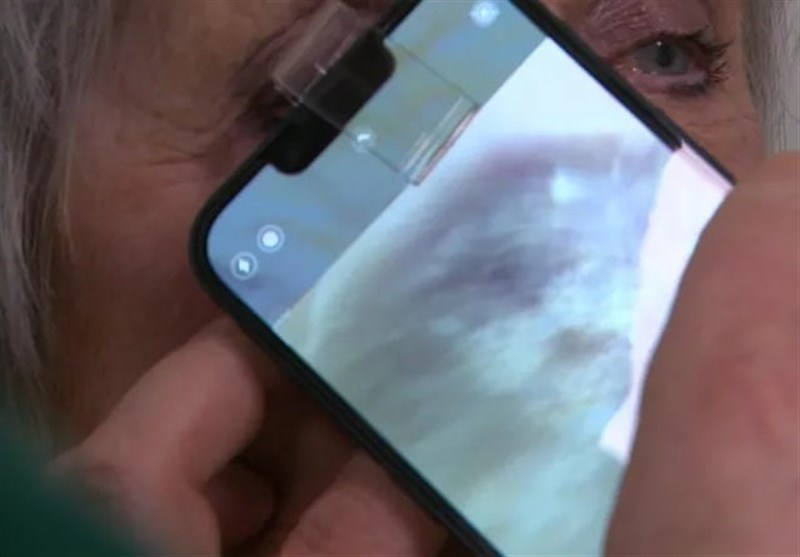 New App Trial Halves Skin Cancer Referrals, Study Finds