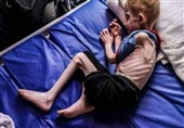 Thousands of Gaza Children Hospitalized for Severe Malnutrition