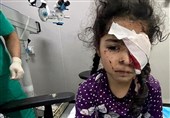 1500 فلسطینی بینایی خود را در جنگ غزه از دست دادهاند