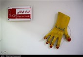 IRCS Center Provides Rehabilitation, Prosthetic Services in Tehran