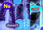Study Finds Vision‑Language Models Flunk Negation, Risking Medical Missteps