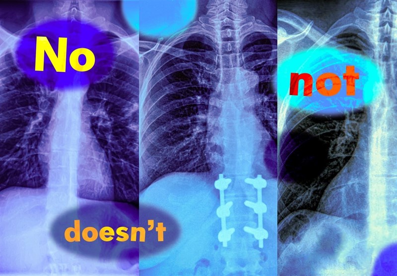 Study Finds Vision‑Language Models Flunk Negation, Risking Medical Missteps