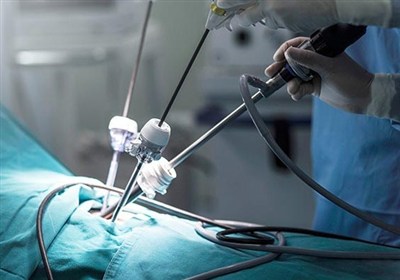 تخمدان،بيمار،جراحي،پزشكي،مويي،محمديان