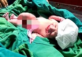 تولد زندگی پس از مرگ؛ نخستین مادر شدن یک زن پیوندی در گیلان