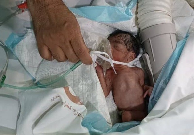 تولد زایمان طبیعی نوزاد از مادر دچار خونریزی مغزی در زاهدان