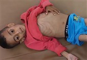 الإعلام الحکومی: وفاة 66 طفلا نتیجة سوء التغذیة بغزة
