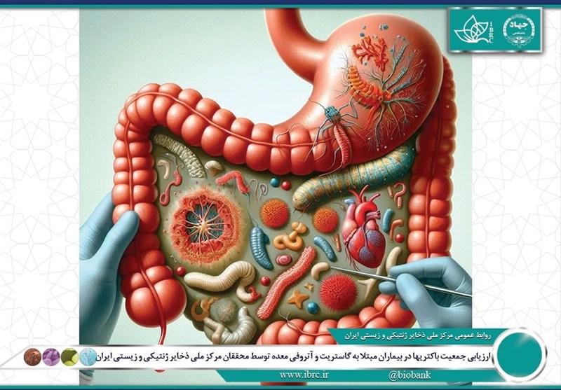 محققان ایرانی ترکیب میکروبی معده بیماران را بررسی کردند
