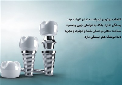 ايمپلنت،برندهاي،قيمت،ايران،كره،كيفيت،برند،–،ضمانت،دندان،جنوب ...
