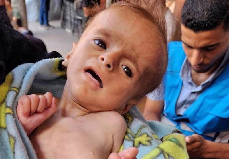 Israeli Minister Backs Starvation Policy in Gaza