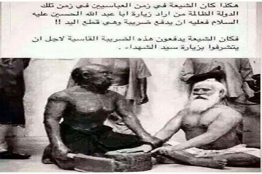 اربعین؛ میراثی که ساده و ارزان به ما نرسید / قطع دست و پا کمترین بها 2