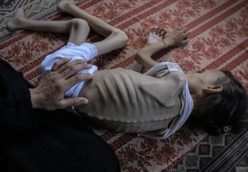Gaza Death Toll Approaches 62,000 As Starvation Claims More Lives